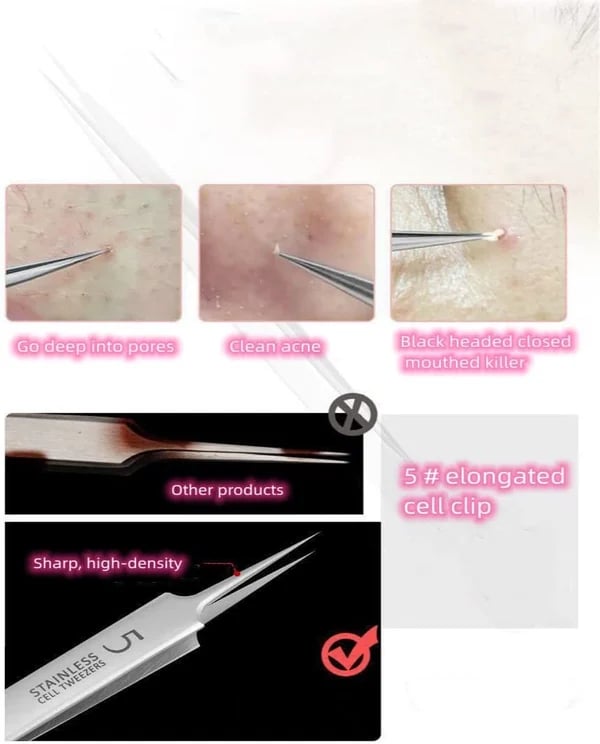 🔥Professional Facial Blackhead Remover Tweezers 🔥